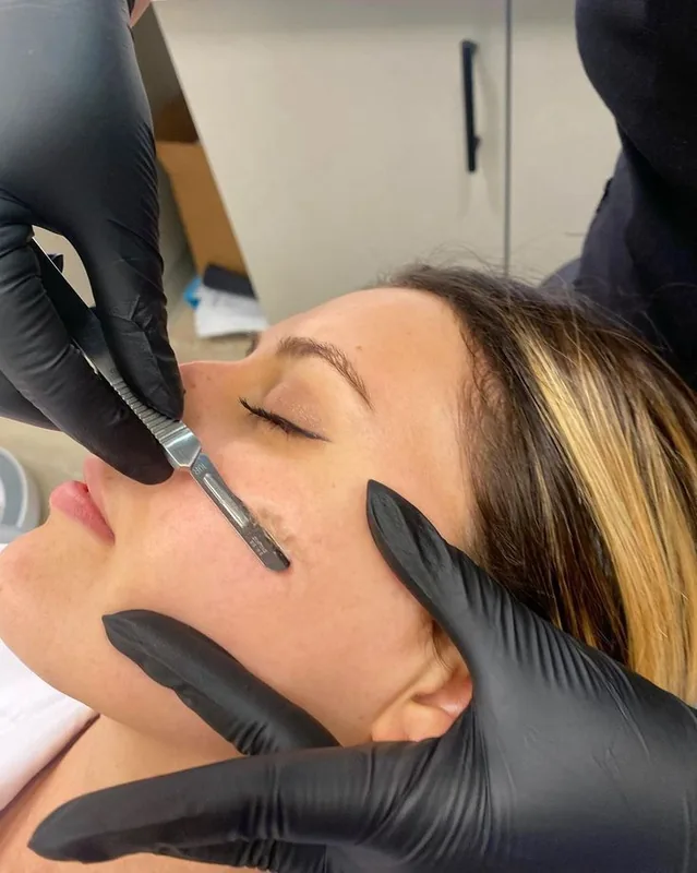 Dermaplaning en Skin Co.